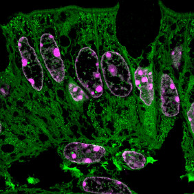 The Hidden Life of Colon Karen Dubois Camacho, University Medical Center Groningen