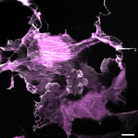 Julia Weingart, University of Wuerzburg, Department of Biophysics