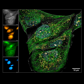 Beyond imaging limits Stefan Sachs, University of Wuerzburg - Department of Biotechnology